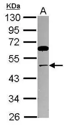Anti-TRIP13 antibody [N1C2] used in Western Blot (WB). GTX119696