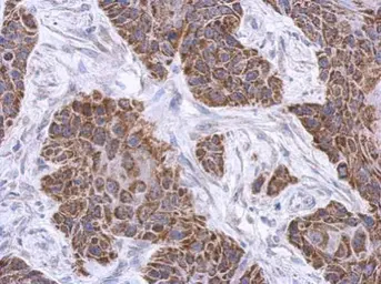 Anti-PLCL2 antibody used in IHC (Paraffin sections) (IHC-P). GTX119699