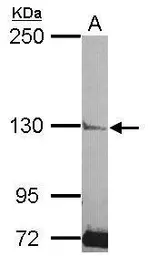 Anti-PLCL2 antibody used in Western Blot (WB). GTX119699