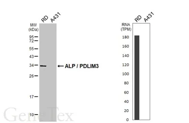 Anti-ALP / PDLIM3 antibody used in Western Blot (WB). GTX119708