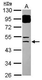 Anti-BTBD6 antibody [N2C2], Internal used in Western Blot (WB). GTX119712