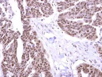 Anti-Stk31 antibody used in IHC (Paraffin sections) (IHC-P). GTX119718