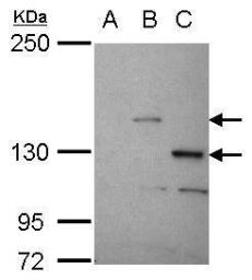 Anti-Stk31 antibody used in Western Blot (WB). GTX119718