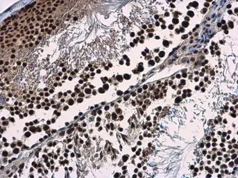 Anti-Wdr62 antibody used in IHC (Paraffin sections) (IHC-P). GTX119724