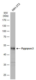 Anti-Pygopus 2 antibody used in Western Blot (WB). GTX119726