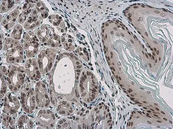 Anti-Pygopus 2 antibody used in IHC (Paraffin sections) (IHC-P). GTX119726