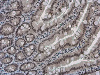 Anti-Pygopus 2 antibody used in IHC (Paraffin sections) (IHC-P). GTX119726