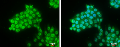Anti-Pygopus 2 antibody used in Immunocytochemistry/ Immunofluorescence (ICC/IF). GTX119726