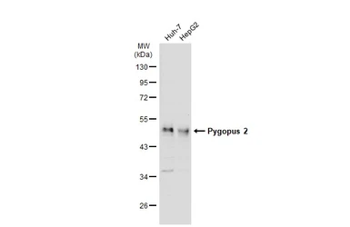 Anti-Pygopus 2 antibody used in Western Blot (WB). GTX119726