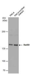 Anti-Rad50 antibody [N1N2], N-term used in Western Blot (WB). GTX119731