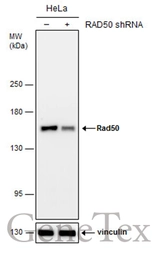 Anti-Rad50 antibody [N1N2], N-term used in Western Blot (WB). GTX119731