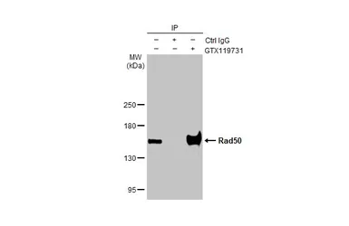 Anti-Rad50 antibody [N1N2], N-term used in Immunoprecipitation (IP). GTX119731