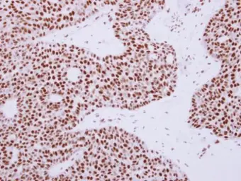 Anti-Rad50 antibody [N1N2], N-term used in IHC (Paraffin sections) (IHC-P). GTX119731