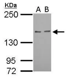 Anti-Rad50 antibody [N1N2], N-term used in Western Blot (WB). GTX119731