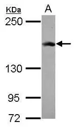 Anti-Rad50 antibody [N1N2], N-term used in Western Blot (WB). GTX119731