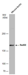 Anti-Rad50 antibody [C1C2], Internal used in Western Blot (WB). GTX119732
