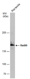 Anti-Rad50 antibody [C1C2], Internal used in Western Blot (WB). GTX119732