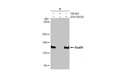 Anti-Rad50 antibody [C1C2], Internal used in Immunoprecipitation (IP). GTX119732