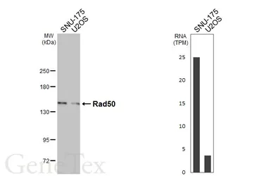 Anti-Rad50 antibody [C1C2], Internal used in Western Blot (WB). GTX119732