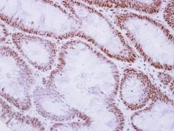 Anti-Rad50 antibody [C1C2], Internal used in IHC (Paraffin sections) (IHC-P). GTX119732