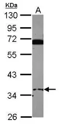 Anti-EID3 antibody [N1C1] used in Western Blot (WB). GTX119734