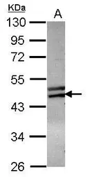 Anti-ZNF439 antibody [N2C1], Internal used in Western Blot (WB). GTX119735