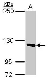 Anti-PITRM1 antibody used in Western Blot (WB). GTX119739