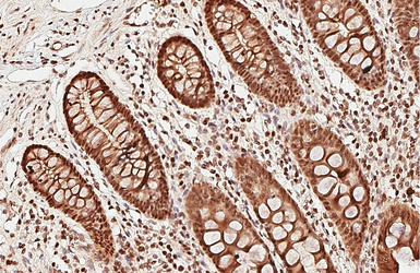 Anti-PSPC1 antibody used in IHC (Paraffin sections) (IHC-P). GTX119744