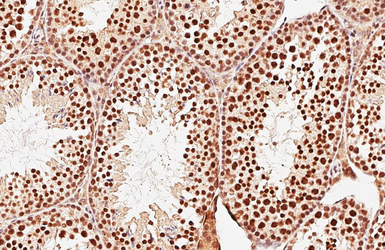 Anti-PSPC1 antibody used in IHC (Paraffin sections) (IHC-P). GTX119744