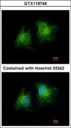 Anti-CCDC28B antibody [N1C3] used in Immunocytochemistry/ Immunofluorescence (ICC/IF). GTX119746