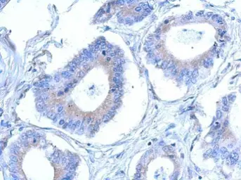 Anti-CCDC28B antibody [N1C3] used in IHC (Paraffin sections) (IHC-P). GTX119746
