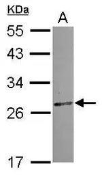 Anti-CCDC28B antibody [N1C3] used in Western Blot (WB). GTX119746