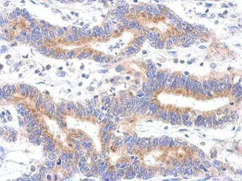 Anti-HDHD3 antibody [N1C3] used in IHC (Paraffin sections) (IHC-P). GTX119747