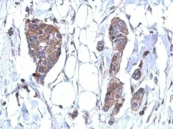 Anti-DDX59 antibody used in IHC (Paraffin sections) (IHC-P). GTX119770