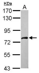 Anti-DDX59 antibody used in Western Blot (WB). GTX119770