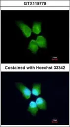 Anti-SLD5 antibody [N1C3] used in Immunocytochemistry/ Immunofluorescence (ICC/IF). GTX119779