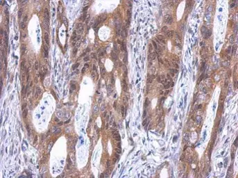 Anti-SLD5 antibody [N1C3] used in IHC (Paraffin sections) (IHC-P). GTX119779