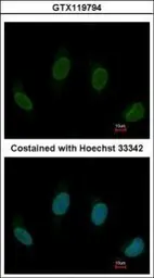Anti-C10orf93 antibody [N1], N-term used in Immunocytochemistry/ Immunofluorescence (ICC/IF). GTX119794