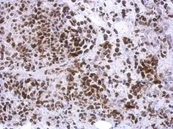 Anti-C10orf93 antibody [N1], N-term used in IHC (Paraffin sections) (IHC-P). GTX119794