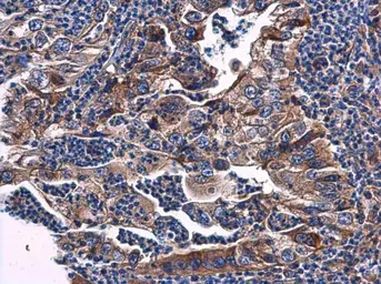 Anti-Phosphatase orphan 2 antibody [N1C3] used in IHC (Paraffin sections) (IHC-P). GTX119798