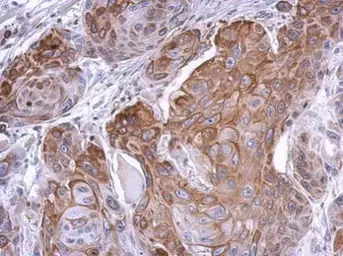 Anti-Phosphatase orphan 2 antibody [N1C3] used in IHC (Paraffin sections) (IHC-P). GTX119798