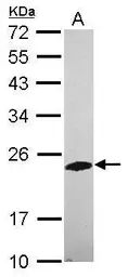 Anti-Phosphatase orphan 2 antibody [N1C3] used in Western Blot (WB). GTX119798