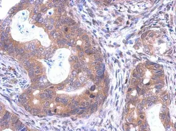 Anti-SKA1 antibody used in IHC (Paraffin sections) (IHC-P). GTX119803