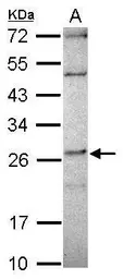 Anti-DPCD antibody [N1C3] used in Western Blot (WB). GTX119808