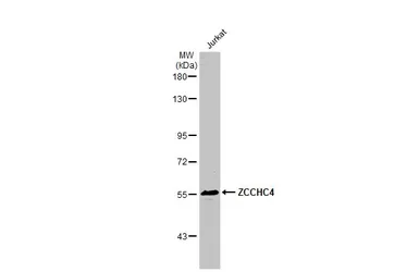 Anti-ZCCHC4 antibody [N1N3] used in Western Blot (WB). GTX119809