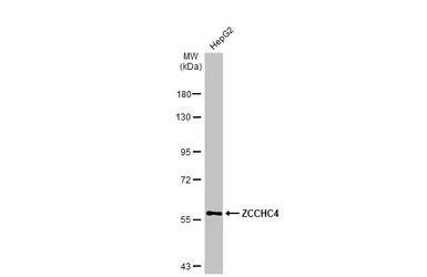 Anti-ZCCHC4 antibody [N1N3] used in Western Blot (WB). GTX119809
