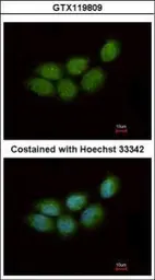 Anti-ZCCHC4 antibody [N1N3] used in Immunocytochemistry/ Immunofluorescence (ICC/IF). GTX119809