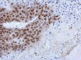 Anti-ZCCHC4 antibody [N1N3] used in IHC (Paraffin sections) (IHC-P). GTX119809
