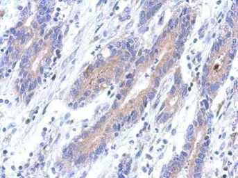 Anti-C12orf41 antibody [N1C2] used in IHC (Paraffin sections) (IHC-P). GTX119816
