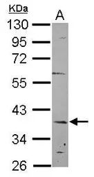 Anti-C12orf41 antibody [N1C2] used in Western Blot (WB). GTX119816